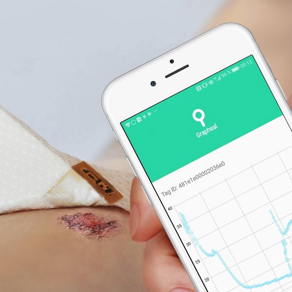 Graphene-based electronic patch to improve chronic wound monitoring