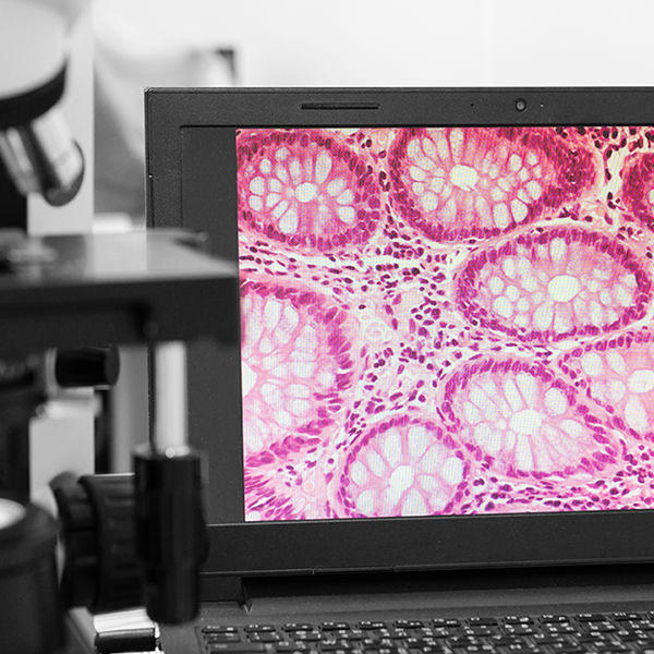 Transforming cancer diagnosis 